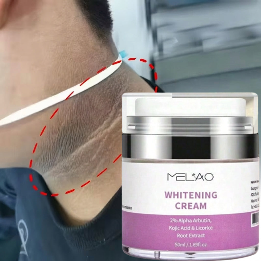 MELAO Whitening Cream with 2% Alpha Arbutin, Kojic Acid & Licorice Root Extract - Brightening Cream for Dark Spots Correction & Even Tone, 1.75 oz