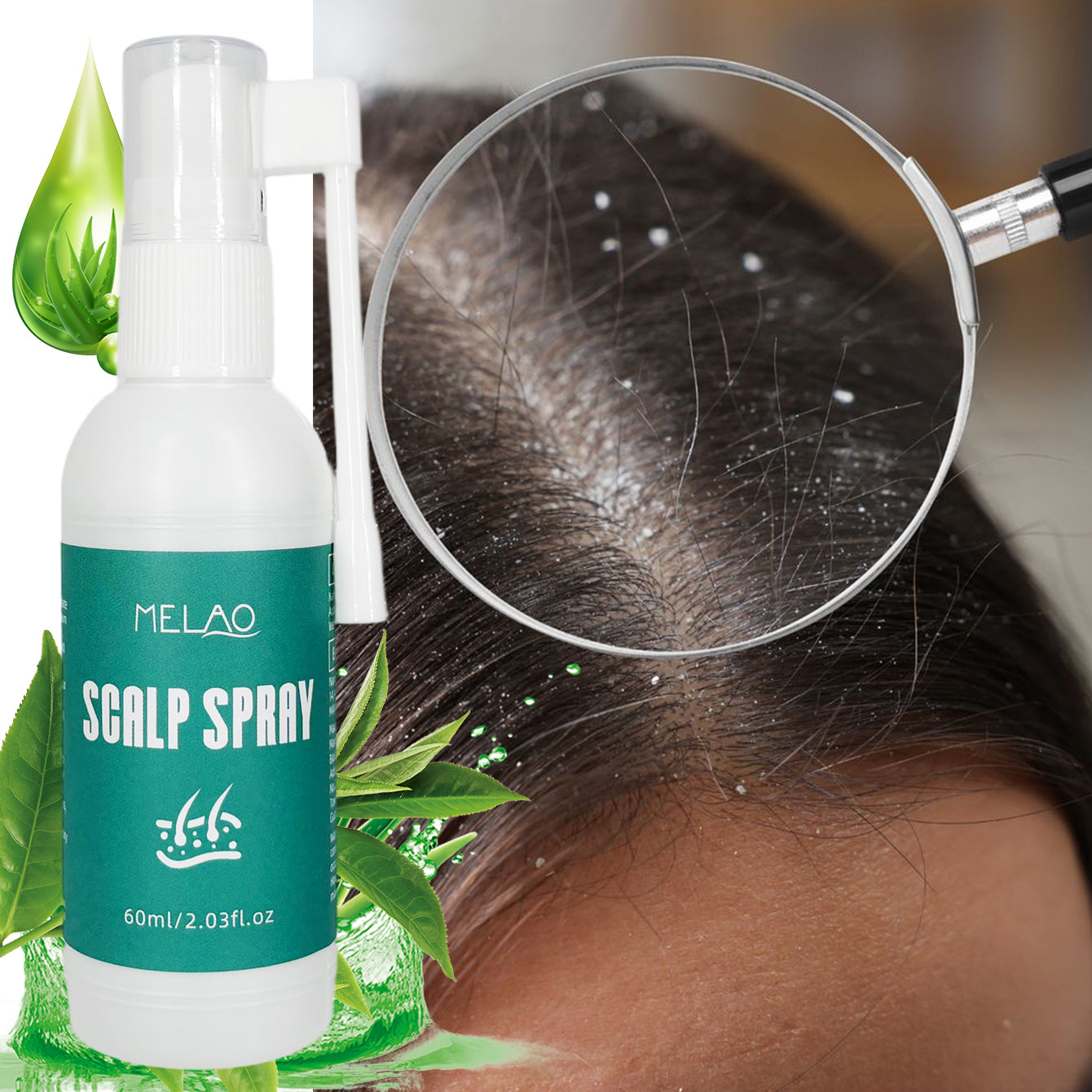 Scalp Spray, MELAO Scalp Spray for Dandruff & Itchy Scalp Relief, with Natural Plant Extracts, Anti Dandruff Treatment, Soothes & Refreshes Scalp, 60ml/2.03fl.oz