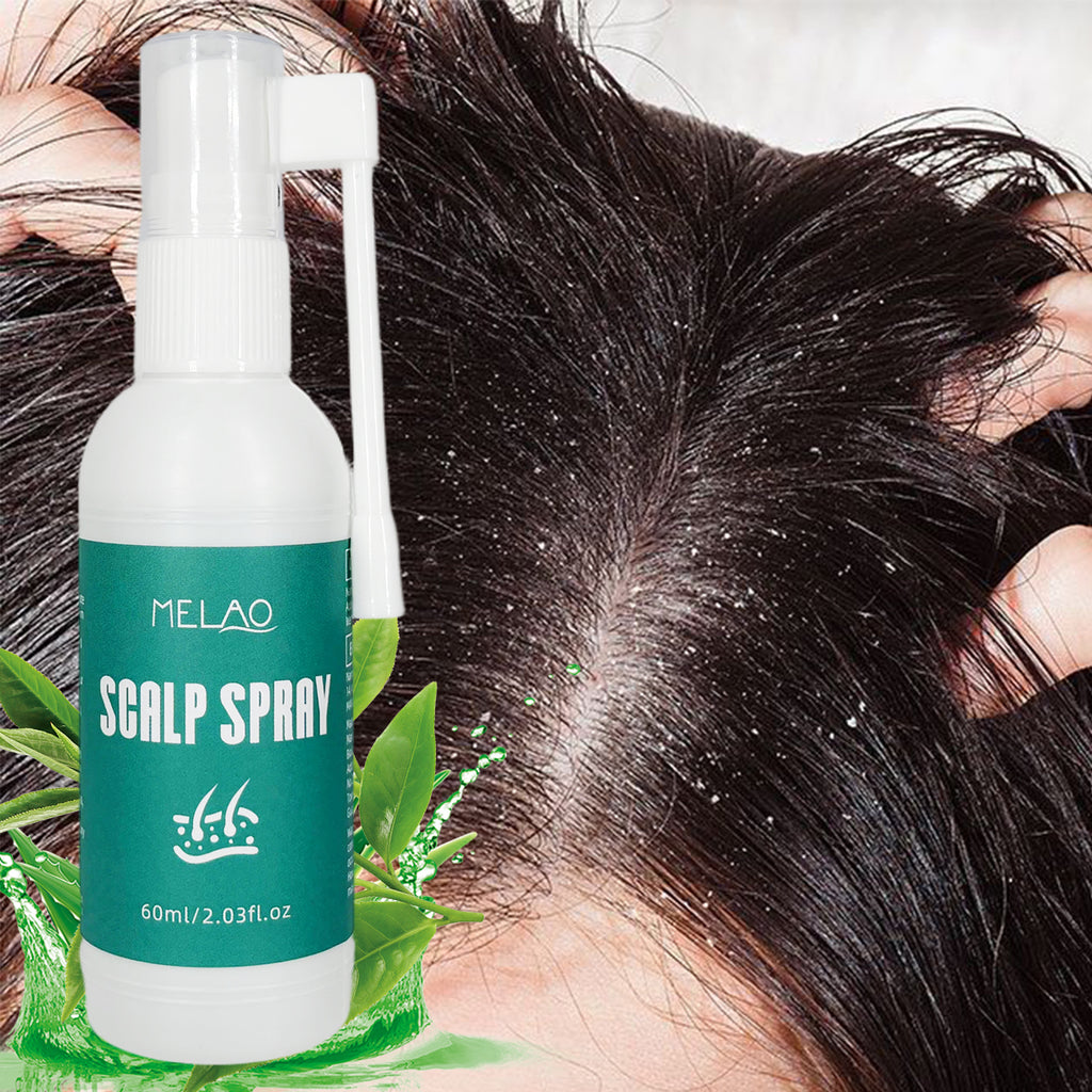Scalp Spray, MELAO Scalp Spray for Dandruff & Itchy Scalp Relief, with Natural Plant Extracts, Anti Dandruff Treatment, Soothes & Refreshes Scalp, 60ml/2.03fl.oz
