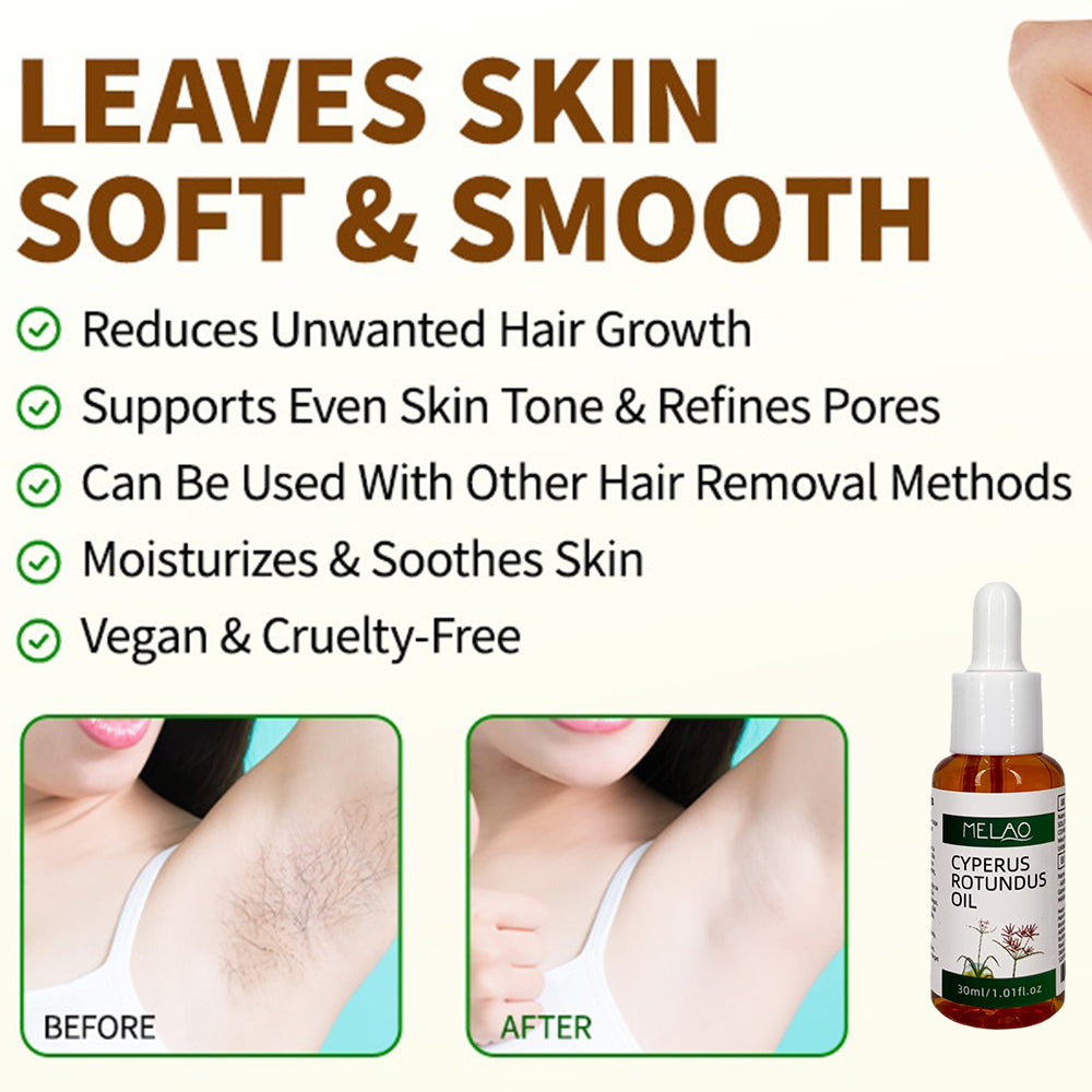 Cyperus Rotundus Oil, MELAO Natural Oil for Unwanted Hair, Helps Manage Hair Appearance, Plant-Based Formula, 30ml/1.01fl.oz