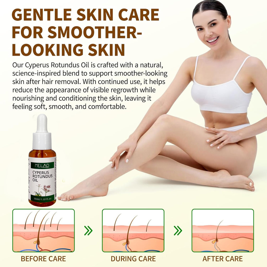 Cyperus Rotundus Oil, MELAO Natural Oil for Unwanted Hair, Helps Manage Hair Appearance, Plant-Based Formula, 30ml/1.01fl.oz