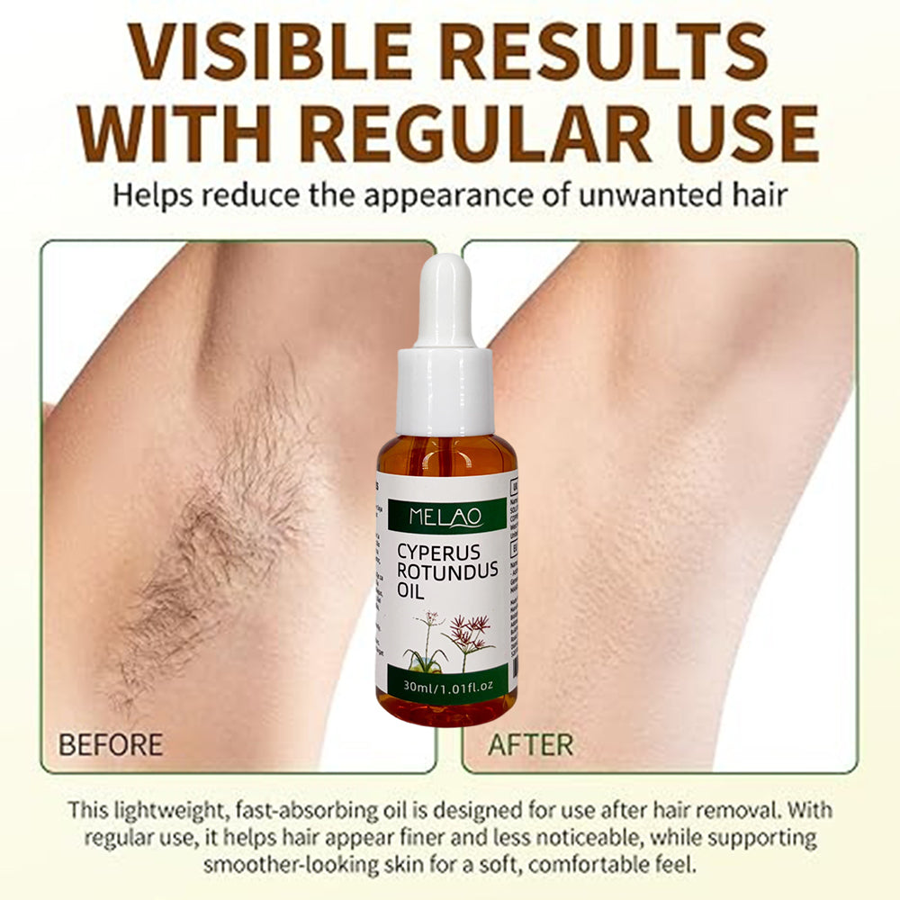 Cyperus Rotundus Oil, MELAO Natural Oil for Unwanted Hair, Helps Manage Hair Appearance, Plant-Based Formula, 30ml/1.01fl.oz