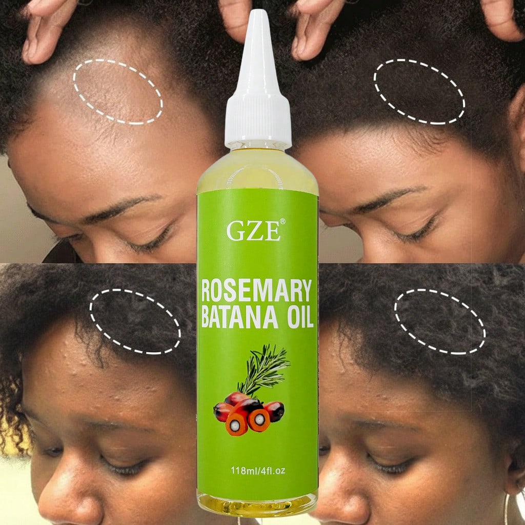 GZE Rosemary Batana Hair Oil - Repairing & Strengthening Hair Treatment Oil for Damaged, Frizzy Hair and Split Ends - with Natural Oils for Smoothing, Silky Shine & Frizz Control - Heat Protectant, Travel Size, 118ml
