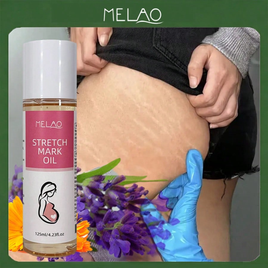 MELAO Firming Body Oil for Stretch Marks, Stretch Mark Oil & Belly Oil, During & After Pregnancy, with Natural Oils, Fades Stretch Marks, Tightens Skin, 125ml