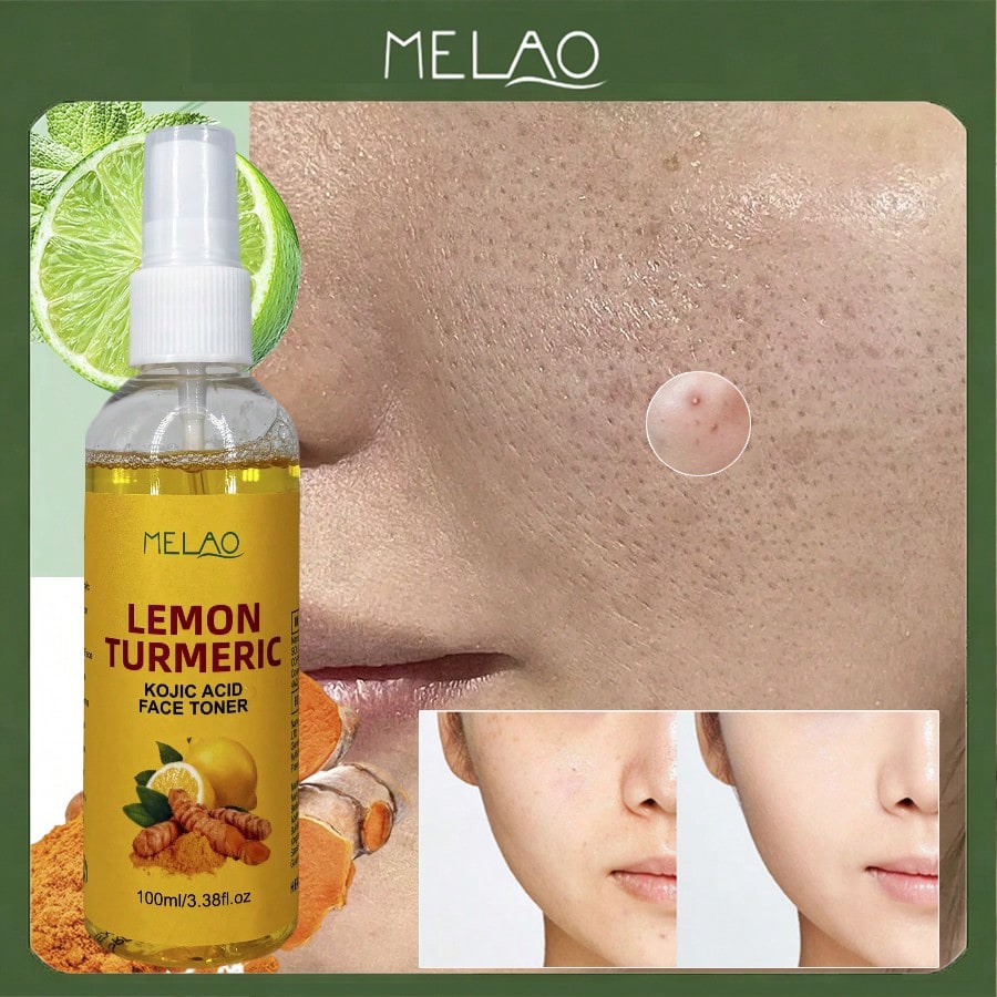 Lemon Turmeric Kojic Acid Face Toner, MELAO Sooting & Clarifying Face Toner, Evens Skin Tone, Minimizes Pores, Refreshes & Balances Skin, Cools After Sun Spray, Long-Lasting Moisturizing