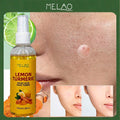 Lemon Turmeric Kojic Acid Face Toner, MELAO Sooting & Clarifying Face Toner, Evens Skin Tone, Minimizes Pores, Refreshes & Balances Skin, Cools After Sun Spray, Long-Lasting Moisturizing