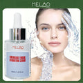 Emergency Facial Hydrating Serum, MELAO Hyaluronic Acid Serum for Dry Skin, Deep Moisturizing Face Serum, Quick Relief for Dehydrated Skin, with Natural Extracts, 30ml/1.01fl.oz