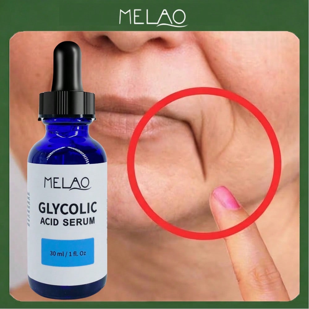 MELAO Glycolic Acid Serum 30ml - 10% AHA Exfoliating Face Serum to Smooth Skin, Reduce Fine Lines & Wrinkles, Improve Skin Texture, and Brighten Dull Skin - Anti-Aging Facial Treatment