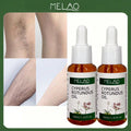 2 Pack MELAO Cyperus Rotundus Oil, 30ml Hair Inhibitor Oil, Reduces Hair & Calms Skin, Natural Ingredient Hair Inhibitor for Body, Arms & Legs