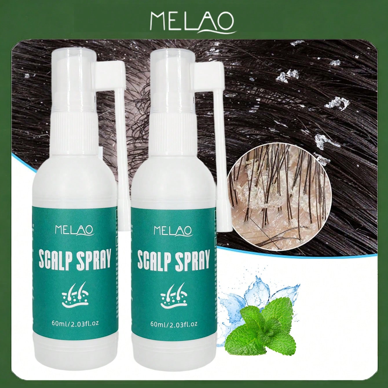 2 Pack MELAO Scalp Spray 60ml, Refreshing & Soothing Scalp Care Spray, Cools & Cleanses the Scalp, Relieves Discomfort & Leaves Scalp Fresh, Comfortable and Hair Light for All Hair Types