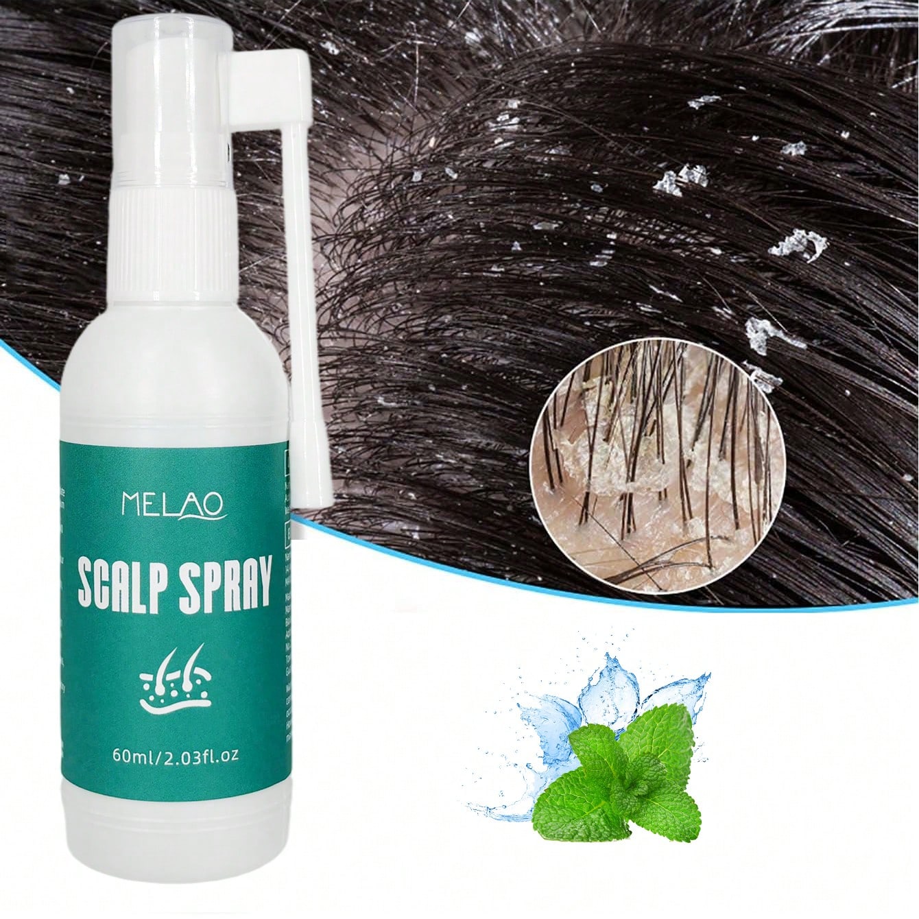 2 Pack MELAO Scalp Spray 60ml, Refreshing & Soothing Scalp Care Spray, Cools & Cleanses the Scalp, Relieves Discomfort & Leaves Scalp Fresh, Comfortable and Hair Light for All Hair Types