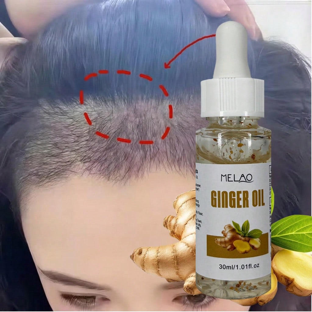 3 Pack MELAO Ginger Oil 30ml, Nourishing Scalp & Hair Care Oil with Visible Natural Ginger Particles, Strengthens Hair Texture, Reduces Dryness & Frizz, Leaves Hair Smooth, Shiny and Healthy for All Hair Types