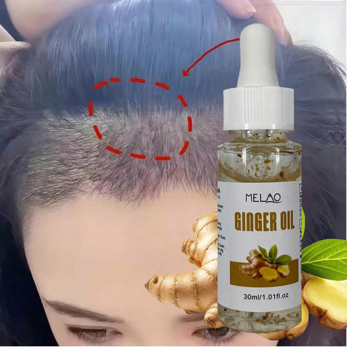 3 Pack MELAO Ginger Oil 30ml, Nourishing Scalp & Hair Care Oil with Visible Natural Ginger Particles, Strengthens Hair Texture, Reduces Dryness & Frizz, Leaves Hair Smooth, Shiny and Healthy for All Hair Types