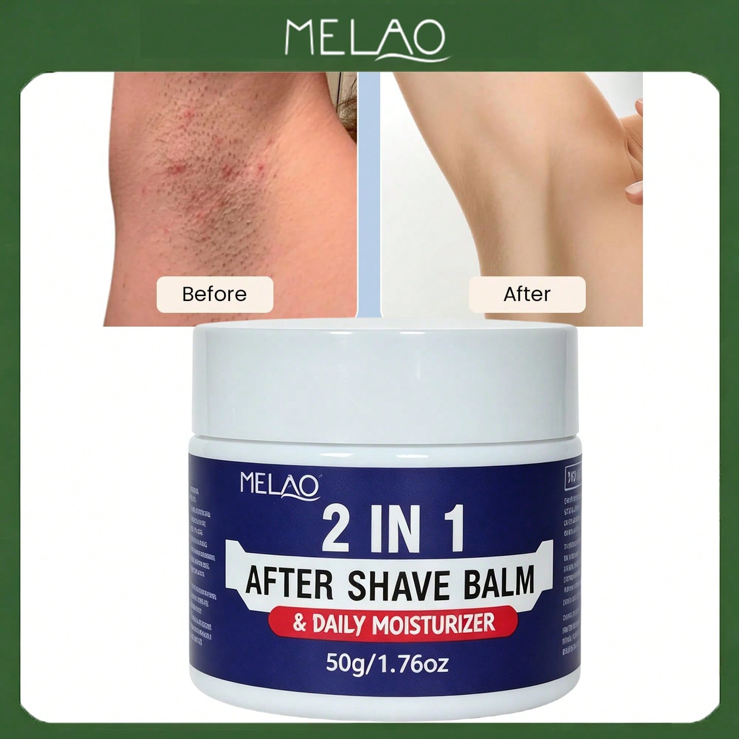 MELAO 2 in 1 After Shave Balm & Daily Moisturizer 50g/1.76oz, Soothes Razor Irritation, Hydrating Post-Shave Repair Cream for Men