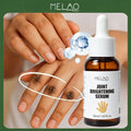 MELAO Joint Brightening Serum 30ml/1.01fl.oz, Dark Spot Corrector for lbows, Lightening Serum on Hands & Joints