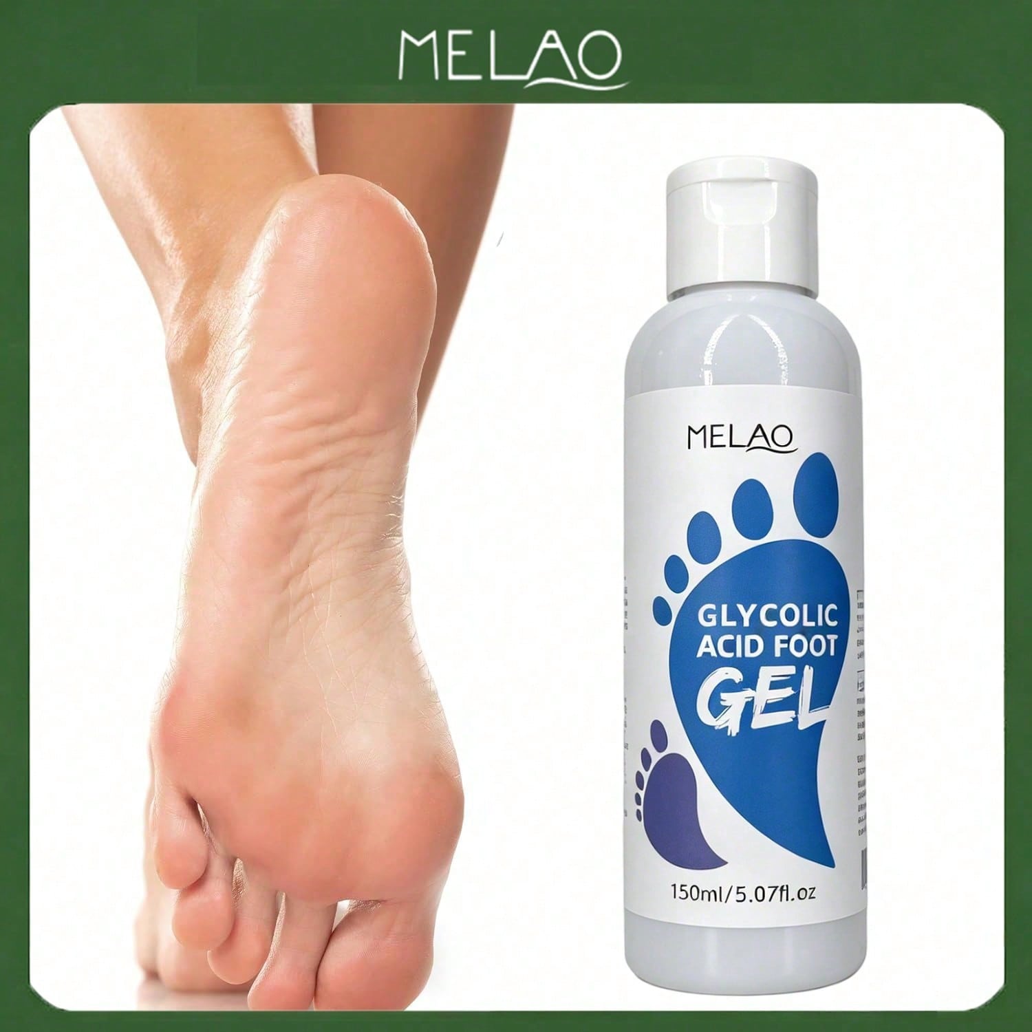 MELAO Glycolic Acid Foot Exfoliating Gel 150ml/5.07fl.oz, Foot Peel Exfoliator, Remove Dead Skin, Calluses & Rough Cracked Heels, Soften Dry Coarse Feet Skin