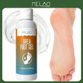 MELAO Urea Foot Exfoliating Gel 150ml/5.07fl.oz, Urea Foot Peel Treatment, Dissolve Dead Skin, Remove Calluses & Repair Cracked Rough Heels, Soften Dry Coarse Feet Skin