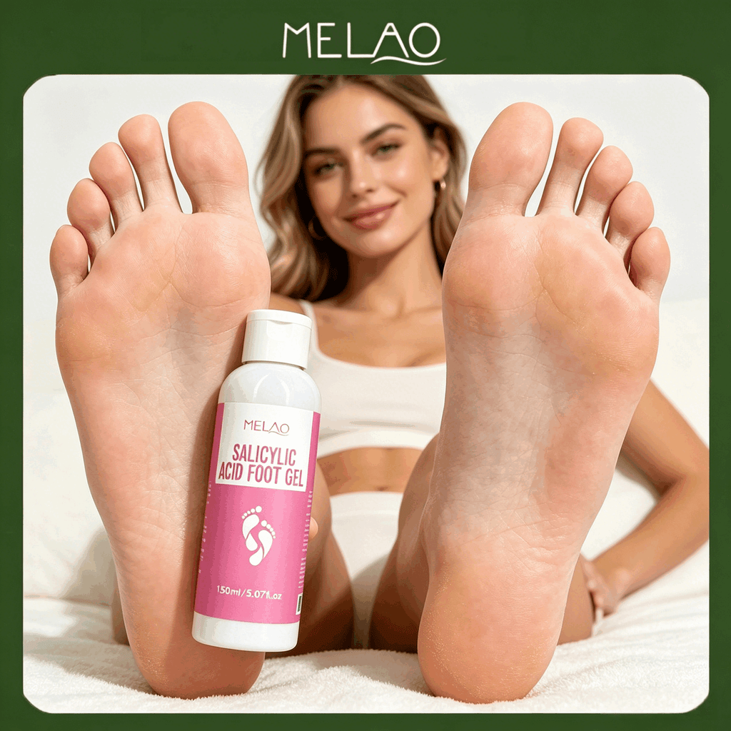 MELAO Salicylic Acid Foot Gel - Dead Skin & Callus Remover, Exfoliating Treatment for Rough Cracked Feet, Softens Heels, 150ml