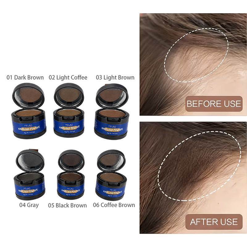 MELAO Hairline Powder Root Concealer - 6 Shades Available, Waterproof, Long-Lasting, Natural Hairline Filler for Thinning Hair, Gray Hair Coverage for Women & Men
