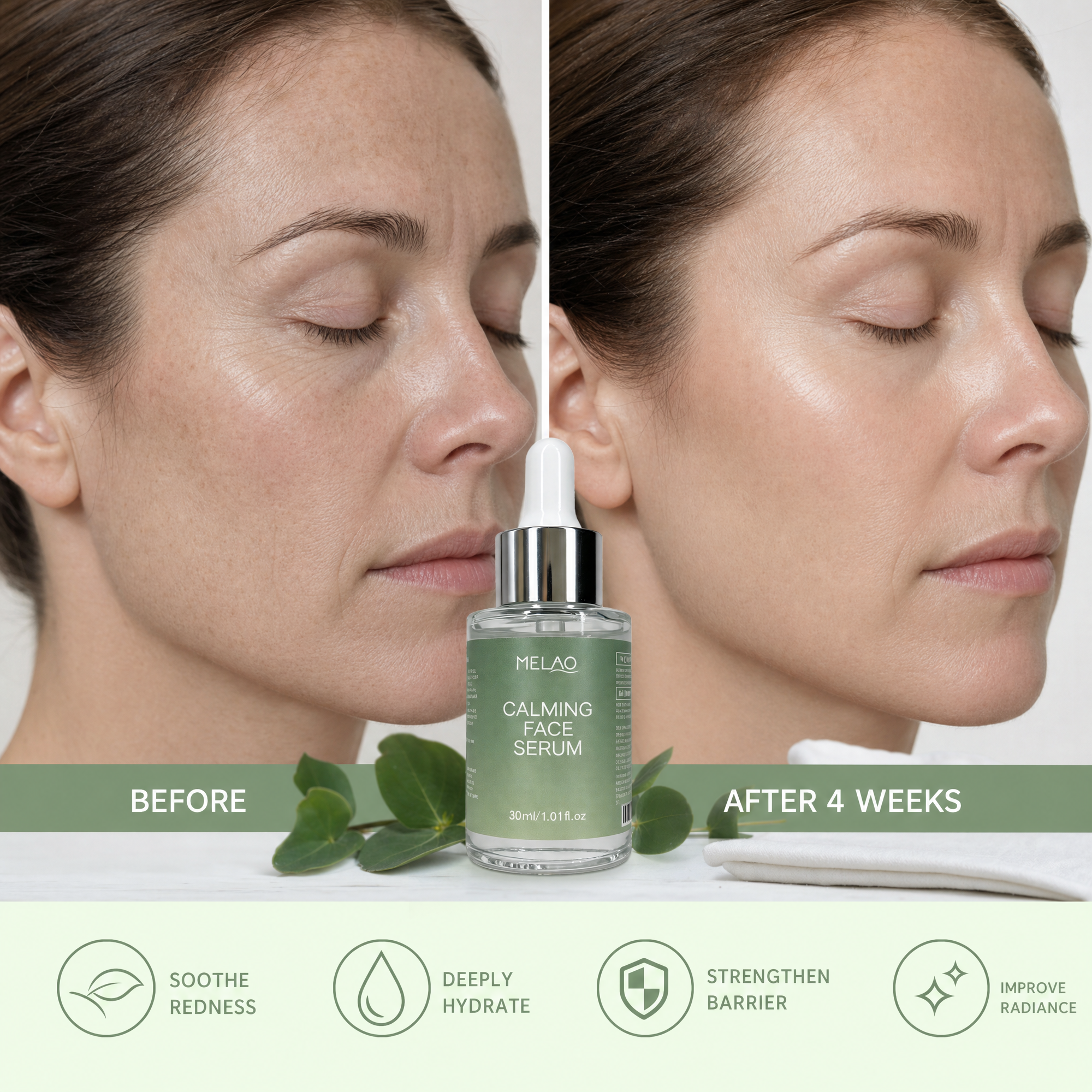 MELAO Calming Face Serum, Soothing &amp; Hydrating Facial Essence for Sensitive &amp; Irritated Skin, Daily Skin Care Serum to Reduce Redness, Calm Discomfort &amp; Support a Healthy, Balanced-Looking Complexion, 30ml