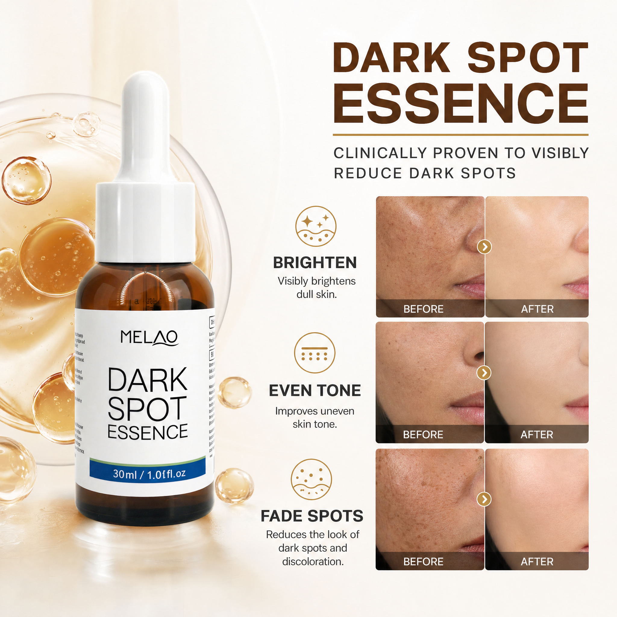 MELAO Dark Spot Brightening Essence, Hydrating & Clarifying Face Serum, Daily Skin Care Serum to Support Smooth, Even-Toned & Glowing Skin, 30ml