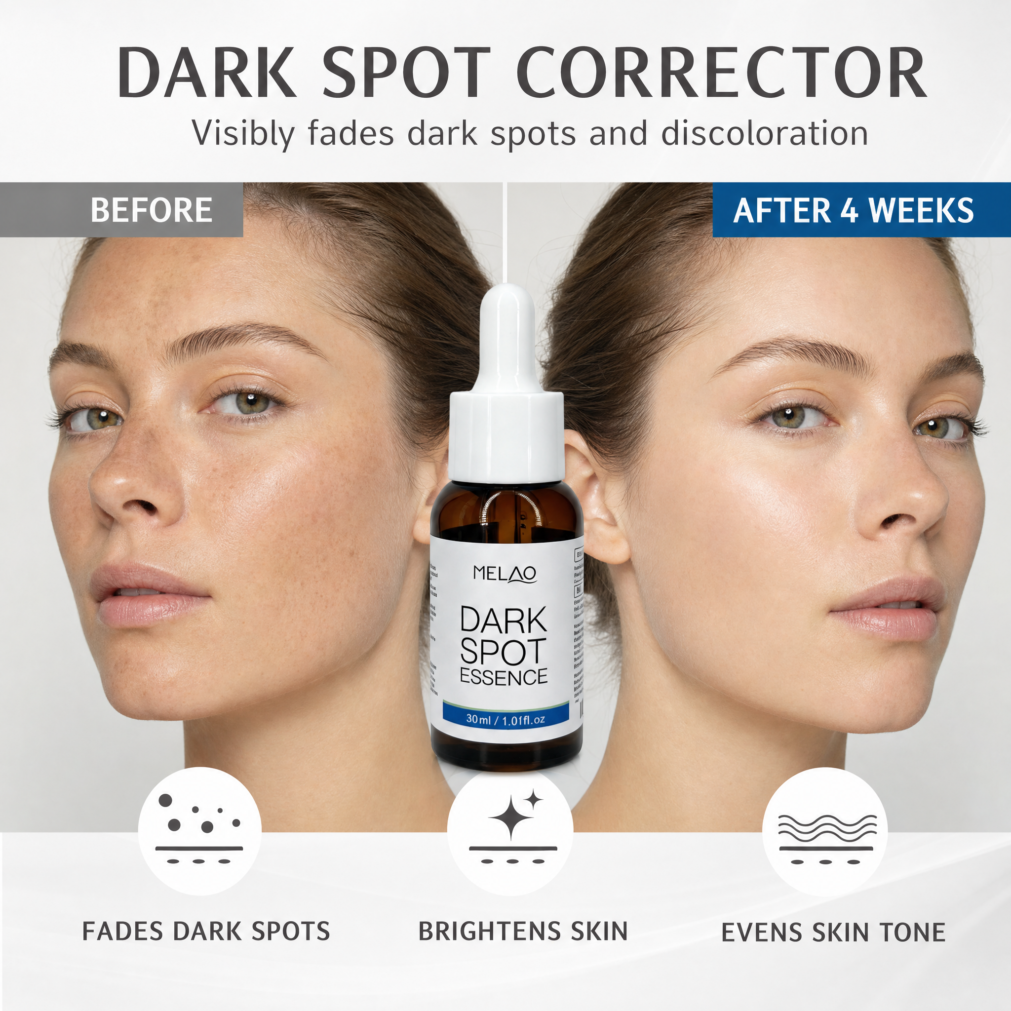 MELAO Dark Spot Brightening Essence, Hydrating & Clarifying Face Serum, Daily Skin Care Serum to Support Smooth, Even-Toned & Glowing Skin, 30ml
